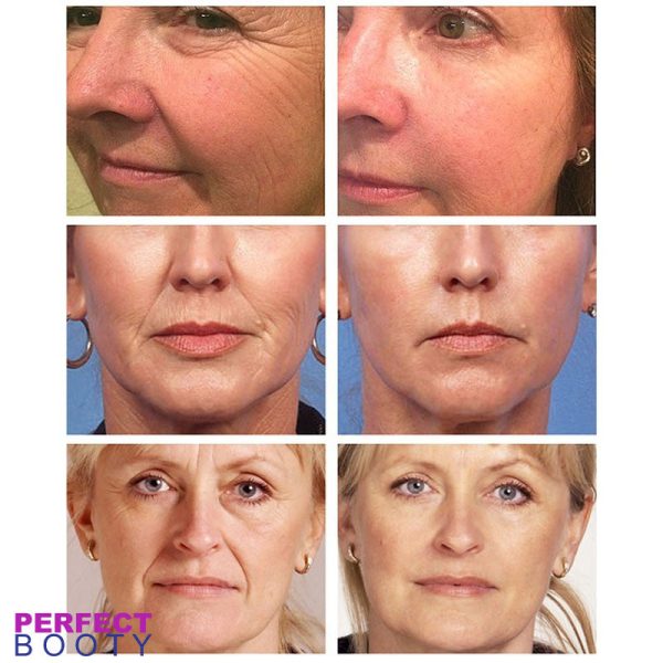Ageless Lifting Cream Verkauf – Bild 5